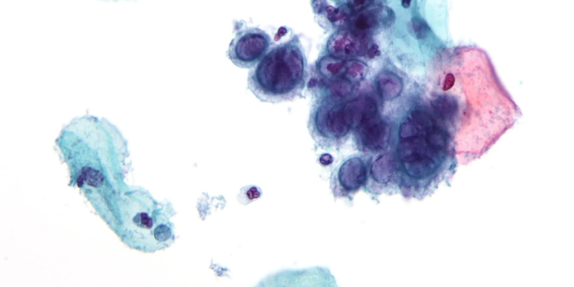 HSV-1 virus