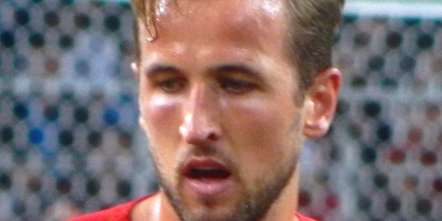 Harry Kane