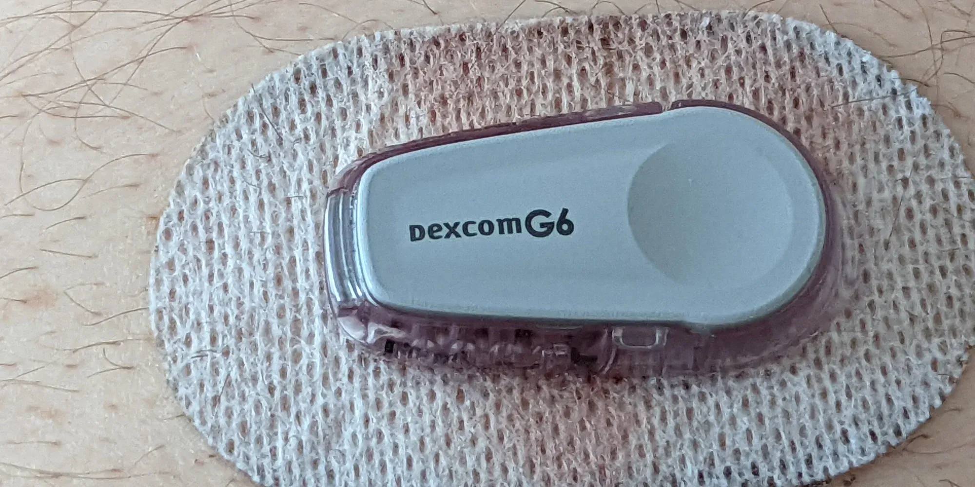 glucose monitor