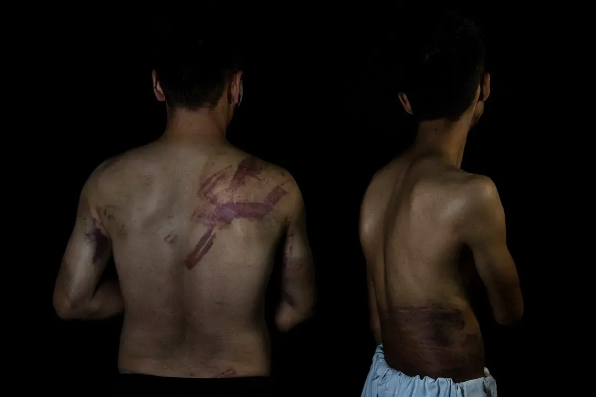 Reporteros afganos fueron detenidos y sometidos a palizas