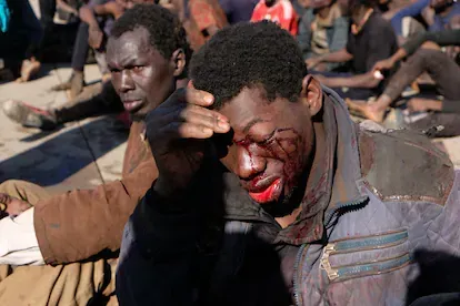 Un migrante herido tras cruzar la valla en Melilla, este miércoles.