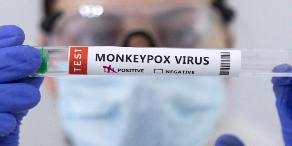 Identifican primer caso de nueva variante de Mpox en Francia