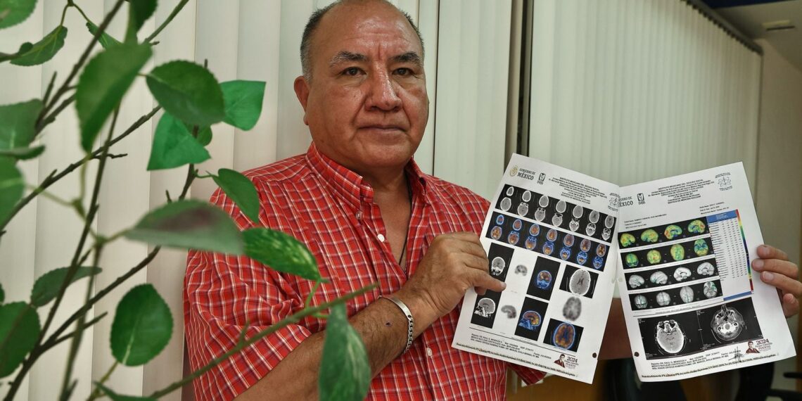 El médico José Maximiliano Rodríguez presenta baja oxigenación hacia el cerebro cinco años después de contagiarse de Covid-19. Foto: Berenice Fregoso