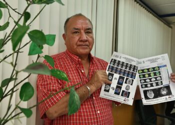 El médico José Maximiliano Rodríguez presenta baja oxigenación hacia el cerebro cinco años después de contagiarse de Covid-19. Foto: Berenice Fregoso