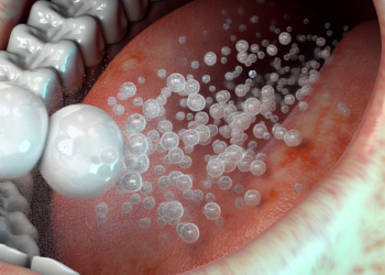 Masticar chicle puede liberar cientos de microplásticos en la saliva, concluye un estudio