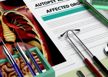 Maradona tenía principales órganos dañados, según autopsia – DW – 02/04/2025