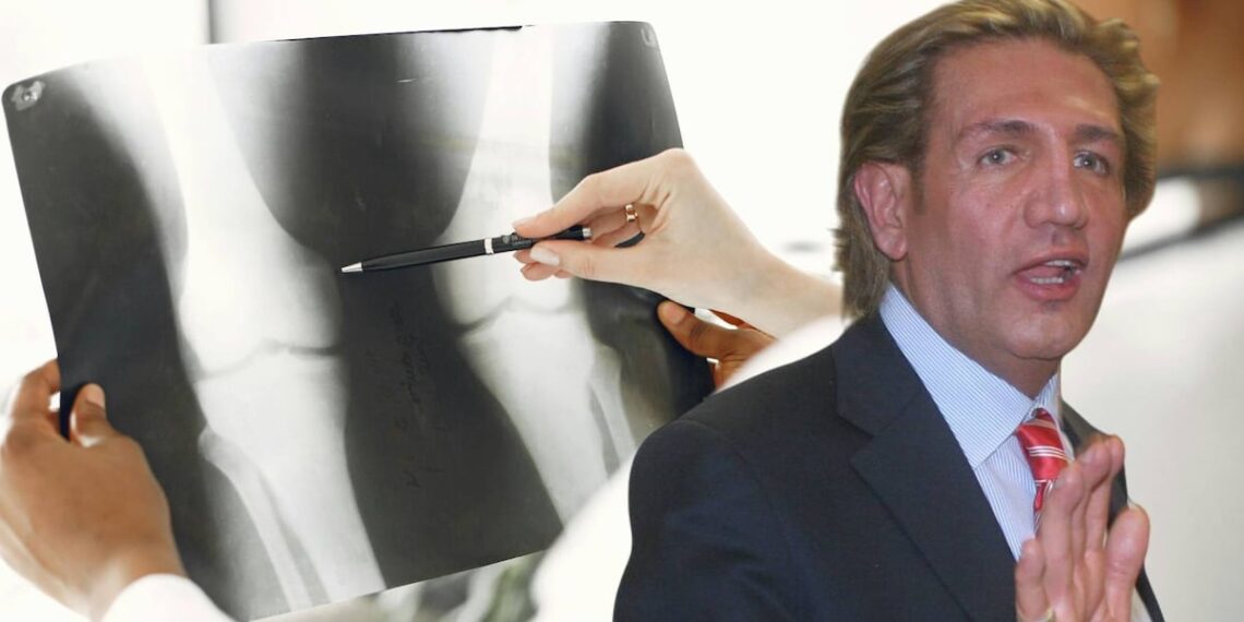 ‘El dolor es terrible’ – El Financiero