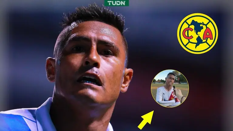 Osvaldo Martínez padece la enfermedad esclerodermia | TUDN Liga MX
