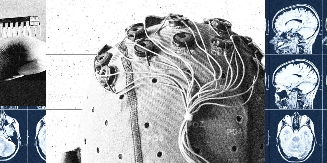 China Is Building a Brain-Computer Interface Industry