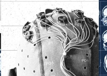 China Is Building a Brain-Computer Interface Industry