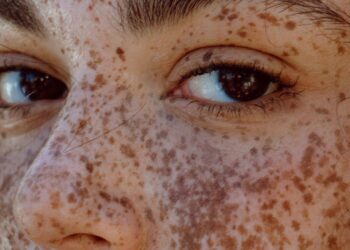 Los Mejores Dispositivos de Radiofrecuencia para Estimular la Producción de Colágeno – Dimension Turistica Magazine