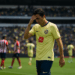 América sufre la baja de Álvaro Fidalgo en el Clásico Nacional ante Chivas