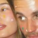 Hailey Bieber Is Healing Her Blisters With…Pimple Patches?